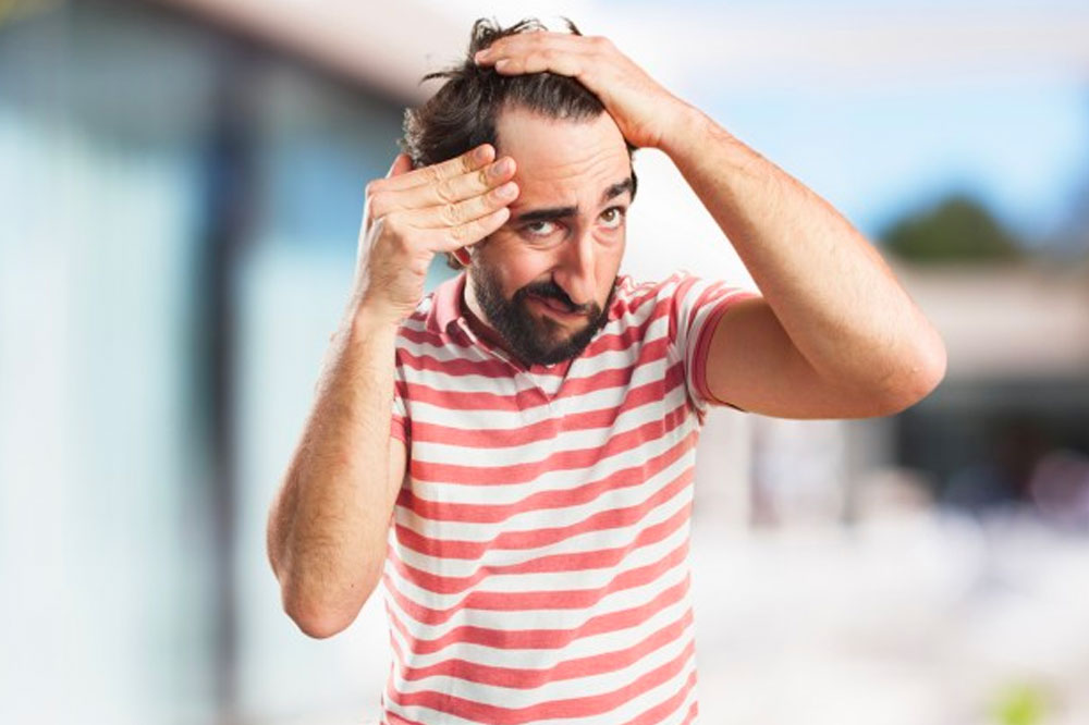 Hair Loss &#8211; Signs and Treatments You Should Know