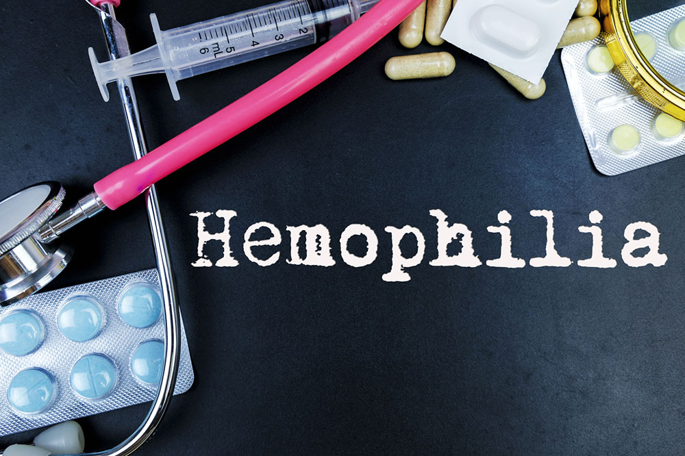 Hemophilia &#8211; Symptoms and Treatment Options